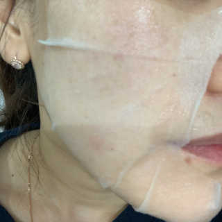 온가족 수분뿜뿜 노랑뚜껑 재주꾼 와우374 스네일토너 — 4점을 준 리뷰어가 2019년 11월 올린 사용 사진