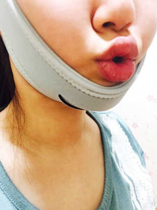 메디미 브이미 업 2스텝 브이라인벨트 — 4.67점을 준 리뷰어가 2017년 5월 올린 사용 사진