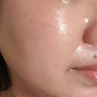 비알티씨 안티폴루션 블랙헤드 클렌징 오일 — 4점을 준 리뷰어가 2019년 3월 올린 사용 사진