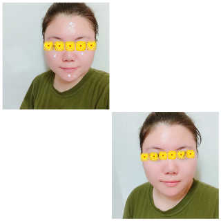 프리[더메디코템] 일루미네이팅 화이트 셀 앰플 — 5점을 준 리뷰어가 2018년 9월 올린 사용 사진