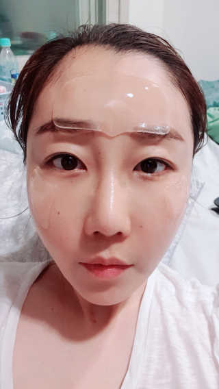 아이디플라코스메틱 아이디 페이스핏 플러스 패치 — 3점을 준 리뷰어가 2019년 10월 올린 사용 사진