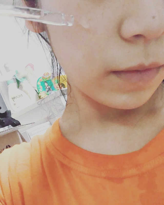 센텔라 90 앰플 리뷰 사진
