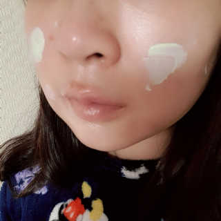 셀퓨전씨 카밍 다운 크림 — 5점을 준 리뷰어가 2018년 11월 올린 사용 사진
