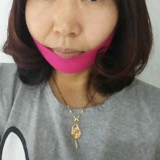 스케덤 펩타이드 리프팅밴드 — 5점을 준 리뷰어가 2019년 6월 올린 사용 사진