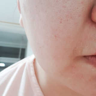 23years old 23Y 콜라겐 펩타이드 앰플 — 4점을 준 리뷰어가 2019년 9월 올린 사용 사진