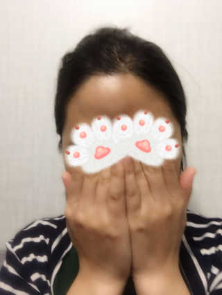 다슈코리아 다슈 데일리 헤어라인 커버 쿠션 — 2.5점을 준 리뷰어가 2017년 4월 올린 사용 사진