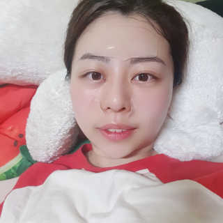 아이디플라코스메틱 아이디 페이스핏 플러스 패치 — 4점을 준 리뷰어가 2019년 10월 올린 사용 사진