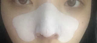 나이팅게일 TAKO PACK NOSE [문어코팩] — 5점을 준 리뷰어가 2016년 12월 올린 사용 사진