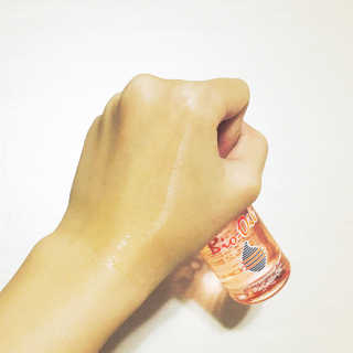 Bio-oil(바이오오일) 바이오오일 — 4점을 준 리뷰어가 2016년 10월 올린 사용 사진