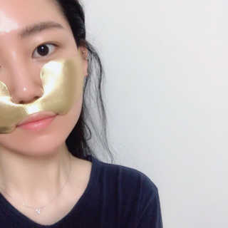 [스케덤] 상악밴드 — 3점을 준 리뷰어가 2019년 6월 올린 사용 사진