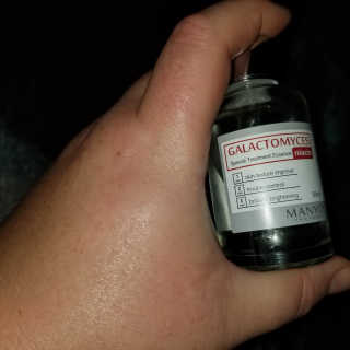 [마녀 공장] 발가락 토미 니아신 에센스 50ml — 4점을 준 리뷰어가 2018년 8월 올린 사용 사진