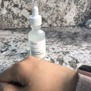 [마녀 공장] 발가락 토미 니아신 에센스 50ml — 5점을 준 리뷰어가 2019년 3월 올린 사용 사진