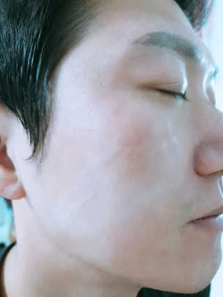 땡큐파머 미라클 에이지 리페어 세럼 — 5점을 준 리뷰어가 2019년 12월 올린 사용 사진