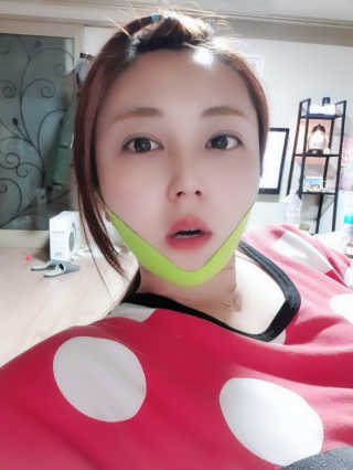 스케덤 시카 리프팅밴드 — 4점을 준 리뷰어가 2019년 4월 올린 사용 사진