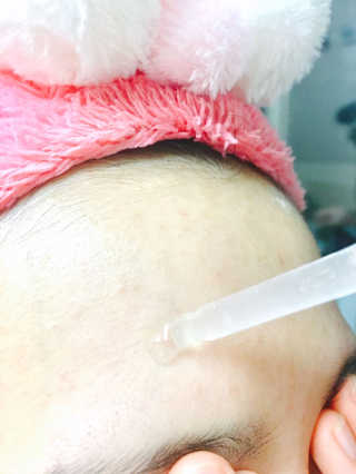 아이소이 파란소화기 응급스팟 — 3.83점을 준 리뷰어가 2018년 3월 올린 사용 사진