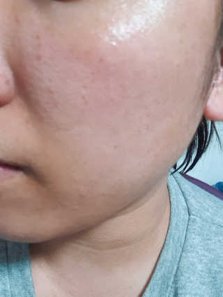 [후르디아] 복숭아 리얼 수딩젤 + 수딩젤 미스트 세트 — 4.5점을 준 리뷰어가 2019년 6월 올린 사용 사진