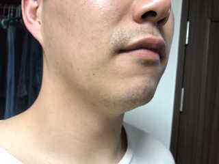 비알티씨 더 퍼스트 앰플 에센스 — 4점을 준 리뷰어가 2019년 4월 올린 사용 사진