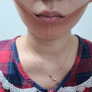 아이디플라코스메틱 아이디 페이스핏 마이너스 밴드 — 5점을 준 리뷰어가 2020년 4월 올린 사용 사진