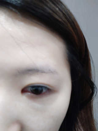 Viewty Skin and Lash [ViewtySkin＆Lash] 종아리 림프순환 부종관리 — 3점을 준 리뷰어가 2019년 4월 올린 사용 사진