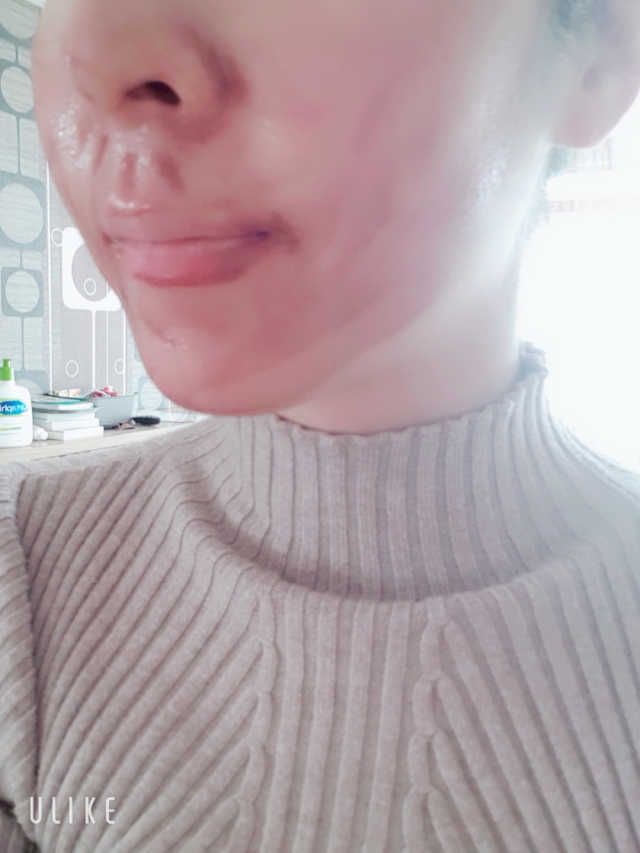 레드 필 팅글 세럼 리뷰 사진