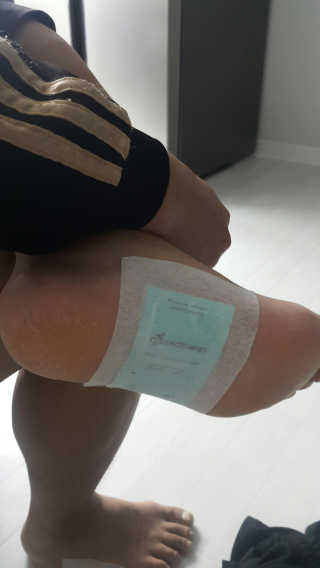 메디테라피 더마 릴렉스 힐링패치 — 5점을 준 리뷰어가 2018년 3월 올린 사용 사진