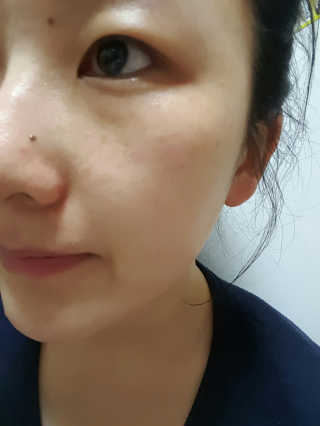 보타니티 [홍]조[진]정[결]케어 플라본 세럼 — 4점을 준 리뷰어가 2018년 5월 올린 사용 사진