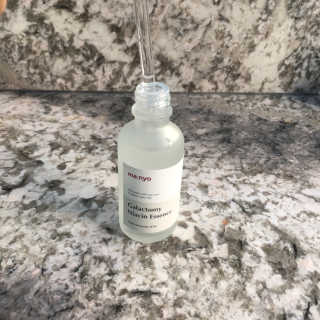 [마녀 공장] 발가락 토미 니아신 에센스 50ml — 5점을 준 리뷰어가 2019년 3월 올린 사용 사진