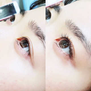 Viewty Skin and Lash [ViewtySkin＆Lash] 종아리 림프순환 부종관리 — 5점을 준 리뷰어가 2019년 3월 올린 사용 사진
