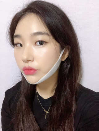 홈앤살롱 집에서 하는 모발클리닉 디스 이즈 앝 — 5점을 준 리뷰어가 2019년 8월 올린 사용 사진