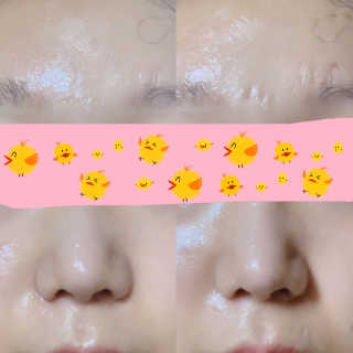 샤인피에이치 쏘큐 리프팅업 페이스 마스크 — 4점을 준 리뷰어가 2019년 1월 올린 사용 사진