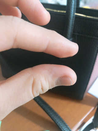 세포랩 바이오제닉 에센스 30ml 특별팩 — 5점을 준 리뷰어가 2018년 5월 올린 사용 사진