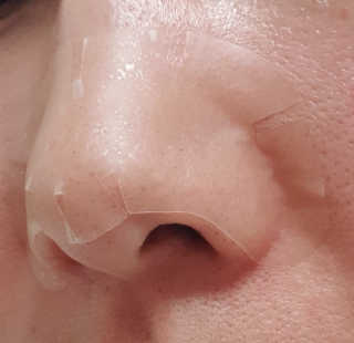 메디힐 슬리핑 멜팅 코팩 — 5점을 준 리뷰어가 2020년 1월 올린 사용 사진