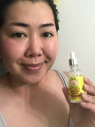 Emogurloveskincare님이 올린 리뷰 사진 1