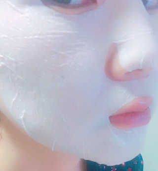 23years old 바데카실 더마실 마스크 — 5점을 준 리뷰어가 2018년 5월 올린 사용 사진