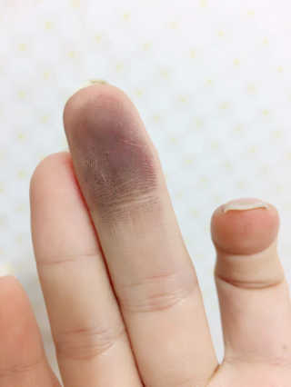 다슈코리아 다슈 안티 헤어로스 헤어쿠션 16g — 2점을 준 리뷰어가 2017년 2월 올린 사용 사진