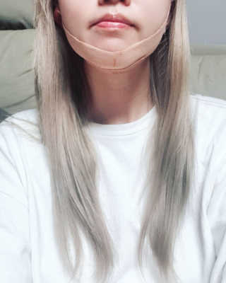 아이디플라코스메틱 아이디 페이스핏 마이너스 밴드 — 4점을 준 리뷰어가 2019년 10월 올린 사용 사진