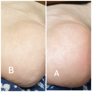 (주)에네스티 에네스티 수안수 실크스킨 풋크림 1+1 — 3점을 준 리뷰어가 2019년 10월 올린 사용 사진