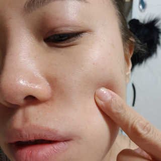 보타니티 [홍]조[진]정[결]케어 플라본 세럼 — 5점을 준 리뷰어가 2018년 5월 올린 사용 사진