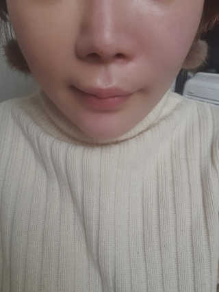 라임코스메틱 V 콜라겐 앰플 쿠션 — 4점을 준 리뷰어가 2020년 2월 올린 사용 사진