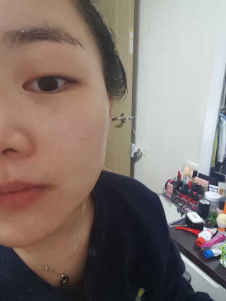 유리스킨 -올인원 토너 순수토너 — 4.67점을 준 리뷰어가 2018년 2월 올린 사용 사진