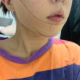 아이디플라코스메틱 아이디 페이스핏 마이너스 밴드 — 5점을 준 리뷰어가 2019년 12월 올린 사용 사진