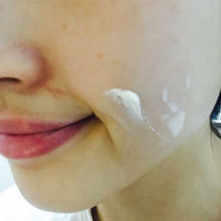 23years old 징크놀 — 3.5점을 준 리뷰어가 2017년 2월 올린 사용 사진