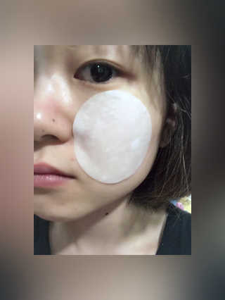 홈메디케어 티트리마스크패드 — 4.5점을 준 리뷰어가 2018년 5월 올린 사용 사진
