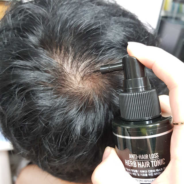 다슈 데일리 안티 헤어로스 허브 헤어토닉 150ml 리뷰 사진
