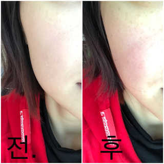 베어블랑 슈퍼 쉴드 쿠션 — 3.33점을 준 리뷰어가 2018년 2월 올린 사용 사진