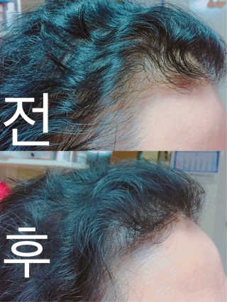 다슈코리아 다슈 안티 헤어로스 헤어쿠션 16g — 3점을 준 리뷰어가 2017년 2월 올린 사용 사진