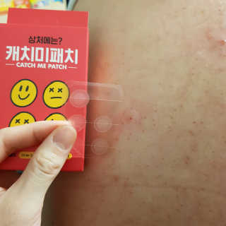 캐치미패치 트러블 스팟패치 — 5점을 준 리뷰어가 2020년 1월 올린 사용 사진