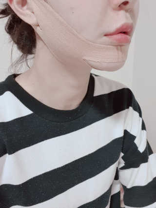아이디플라코스메틱 아이디 페이스핏 마이너스 밴드 — 3점을 준 리뷰어가 2019년 9월 올린 사용 사진