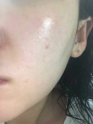 로벡틴 아쿠아 UV 프로텍터 — 3점을 준 리뷰어가 2019년 6월 올린 사용 사진