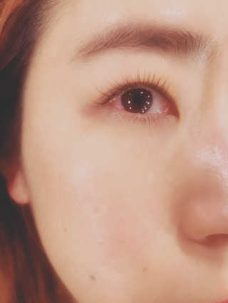 Viewty Skin and Lash [ViewtySkin＆Lash] 종아리 림프순환 부종관리 — 1점을 준 리뷰어가 2019년 4월 올린 사용 사진